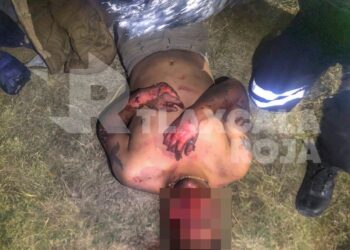 Rocían gasolina a un sujeto para lincharlo en Tenango, Tetlatlahuca; su pareja fue golpeada con un block en la cabeza