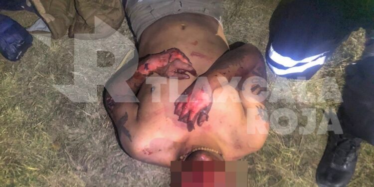 Rocían gasolina a un sujeto para lincharlo en Tenango, Tetlatlahuca; su pareja fue golpeada con un block en la cabeza