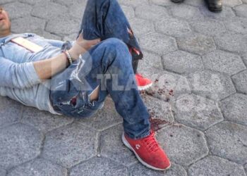 Trascabo le destroza pierna a hombre en Zacatelco