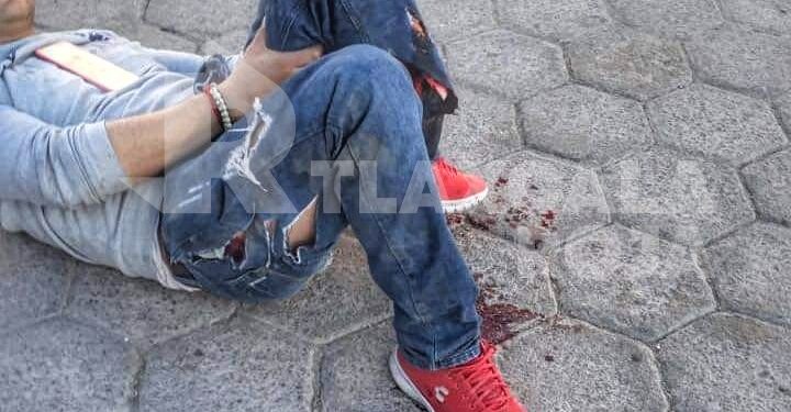 Trascabo le destroza pierna a hombre en Zacatelco