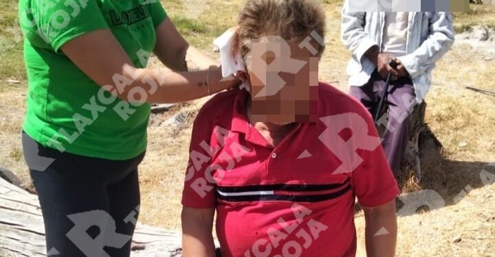 Con escopeta atacan a masculino en Atlangatepec