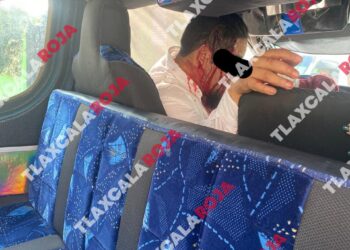 Lesionan a conductor del transporte público para asaltarlo en Miraflores