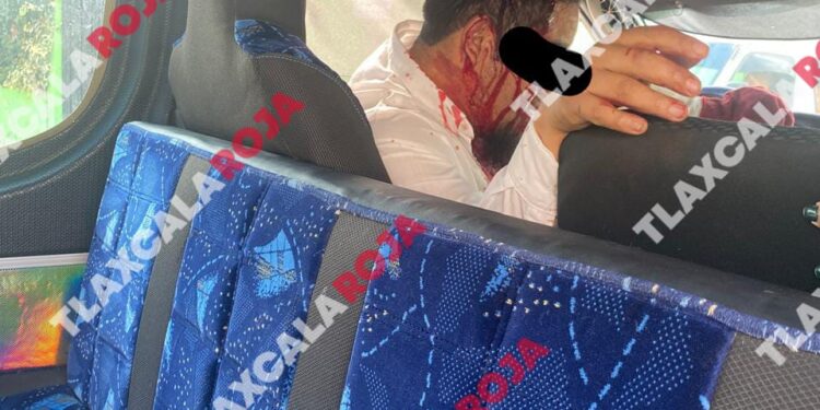 Lesionan a conductor del transporte público para asaltarlo en Miraflores