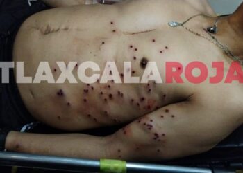 Cinco hombres baleados deja riña en Huamantla