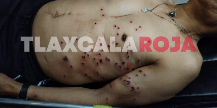 Cinco hombres baleados deja riña en Huamantla